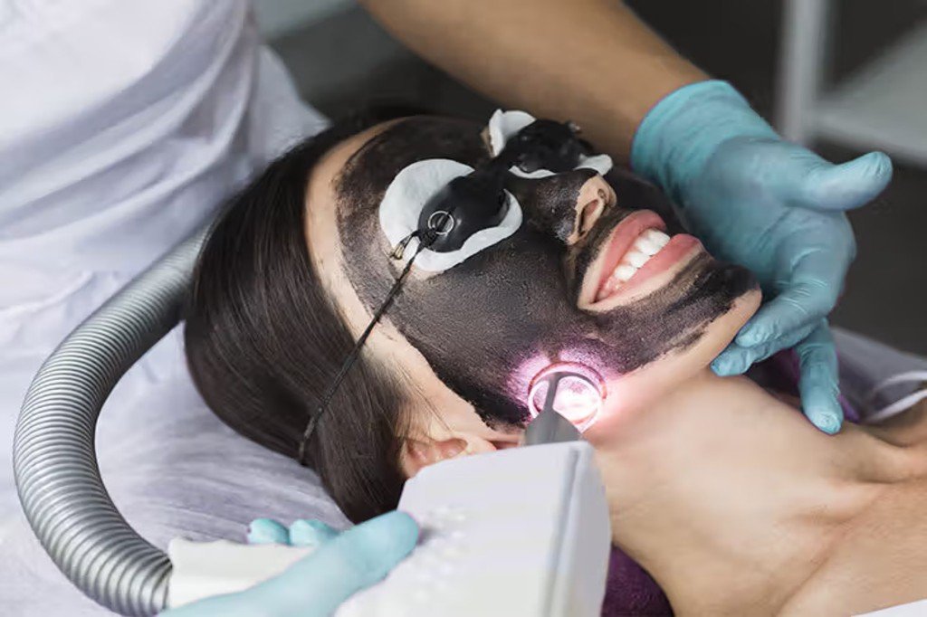 Carbon Laser Peel Treatment in Mumbai