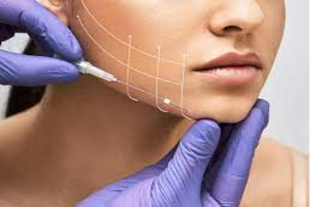 Thread Lift Treatment in Mumbai