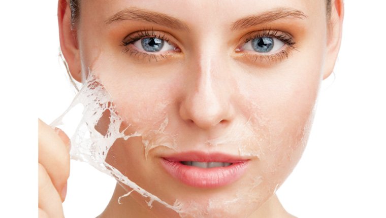 chemical peel in kolkata